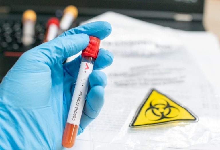 If I Have COVID 19, Should I Take The Vaccine? If I Have COVID 19, Should I Take The Vaccine?