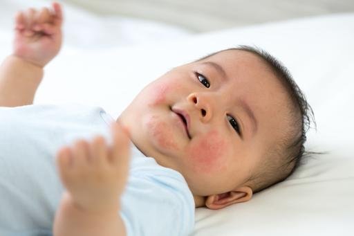 Can A Baby Indicate Its Exposure To Allergies?