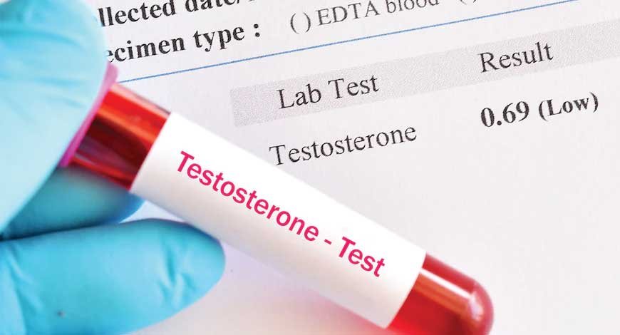 Lower Levels Of Testosterone In Men Impose A Higher Risk Of Covid-19 Infections