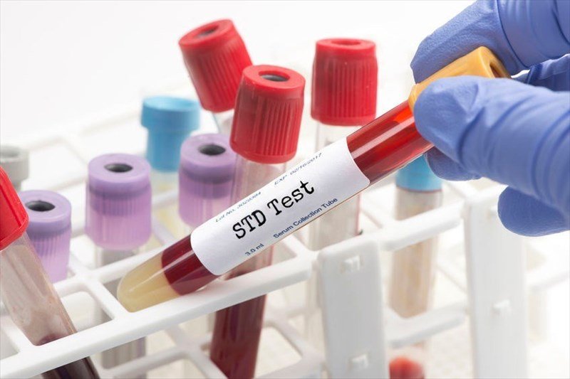 In The United States, STDs Have Reached Its Highest For The 6th Year In A Row